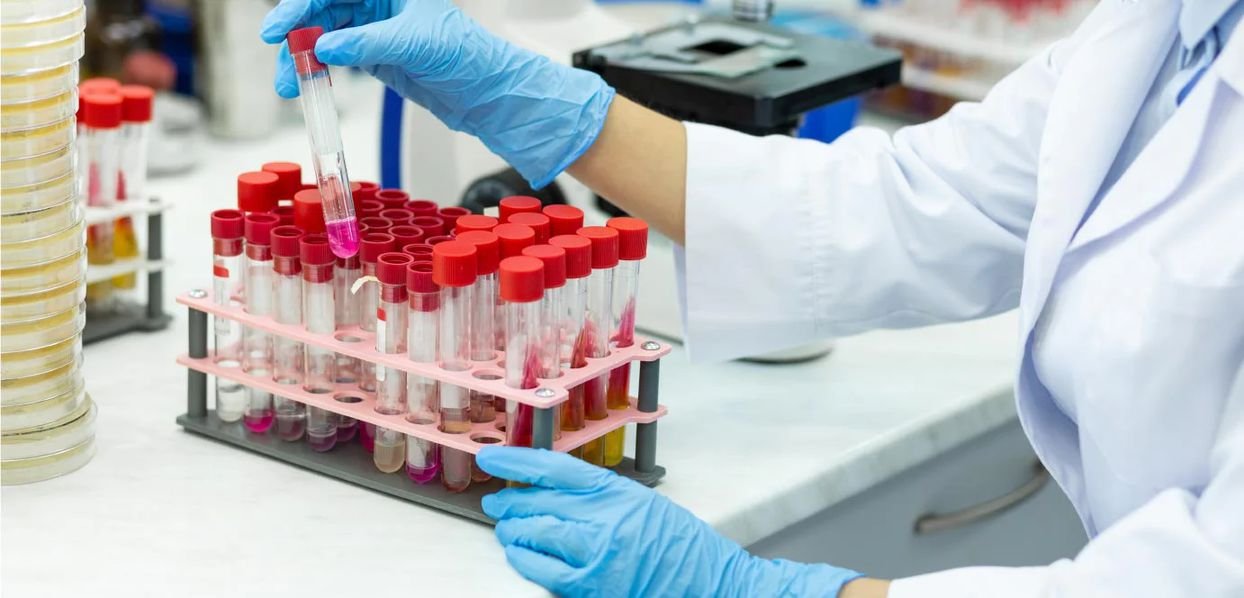 Reactivos de Laboratorio